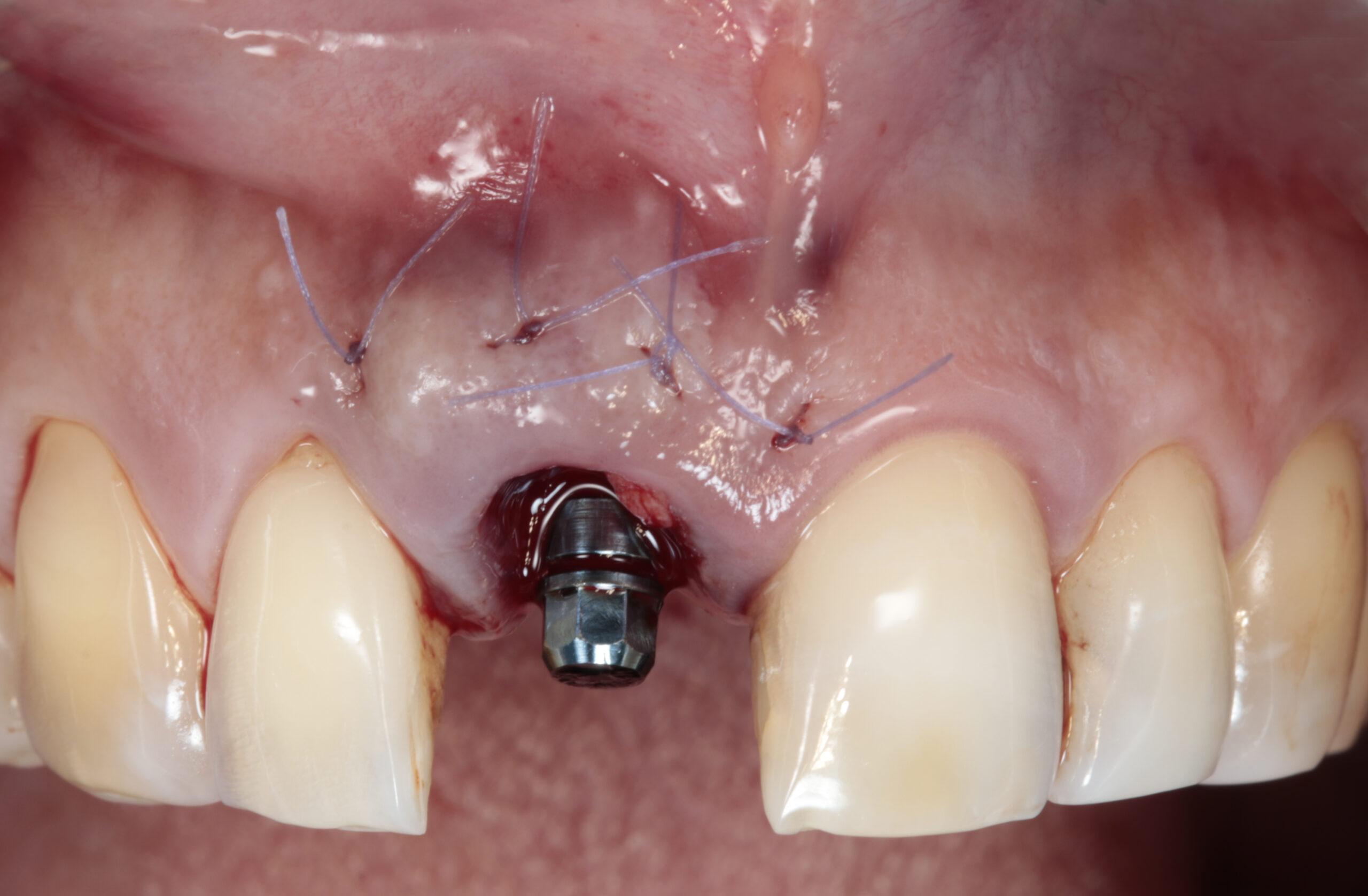 dental school requirements