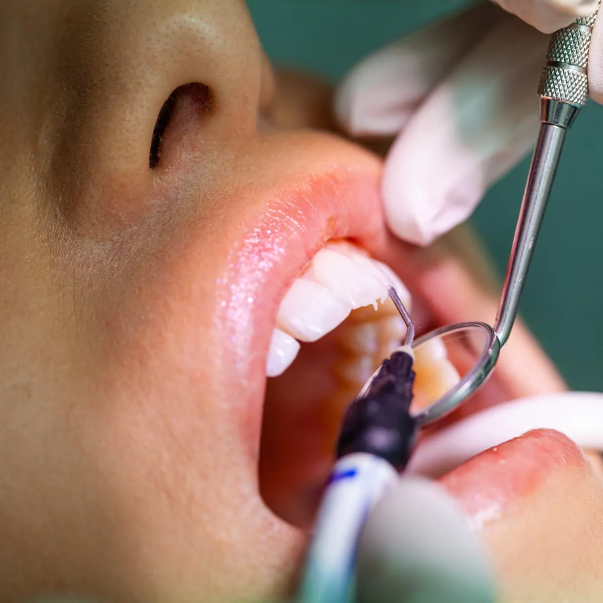 become a dentist