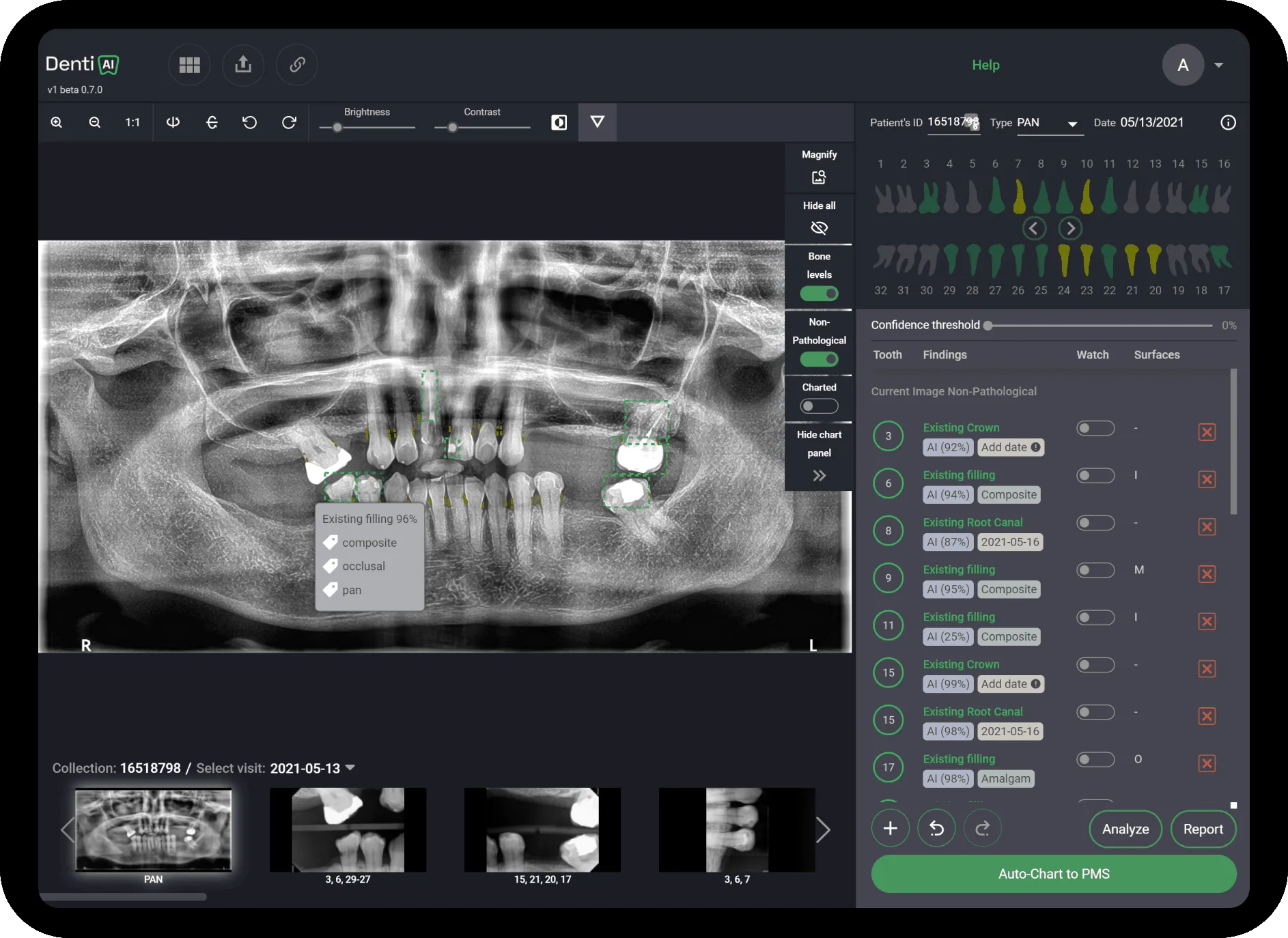 AI Dental Diagnostic Software