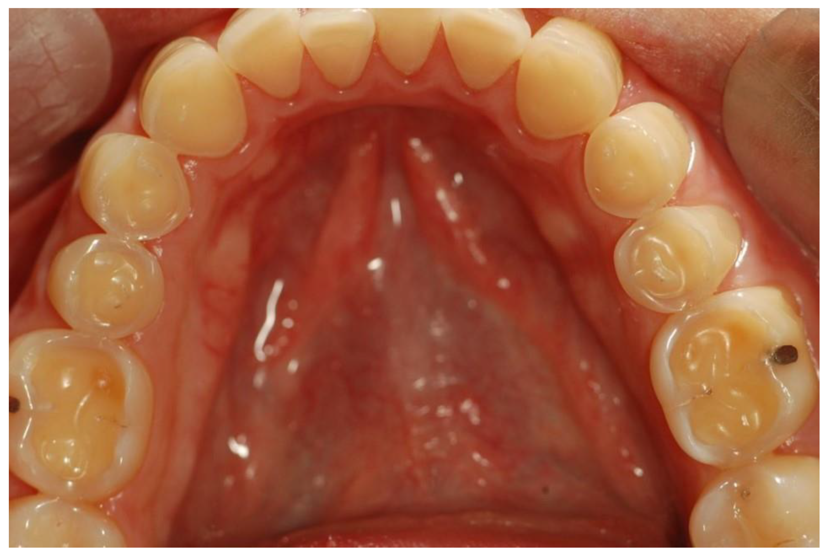MyPlate dental health nutrition