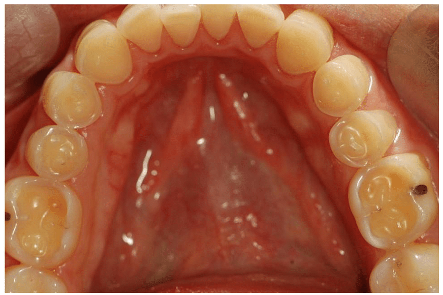 MyPlate dental health nutrition