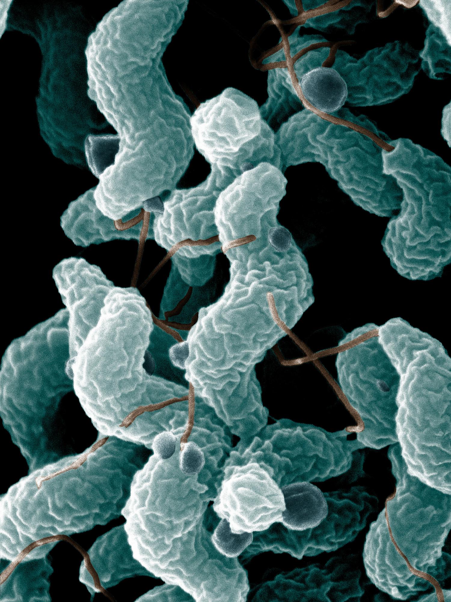 Fusobacterium bacteria oral