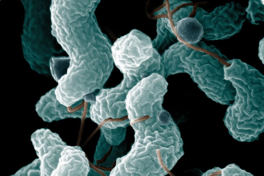 Fusobacterium bacteria oral
