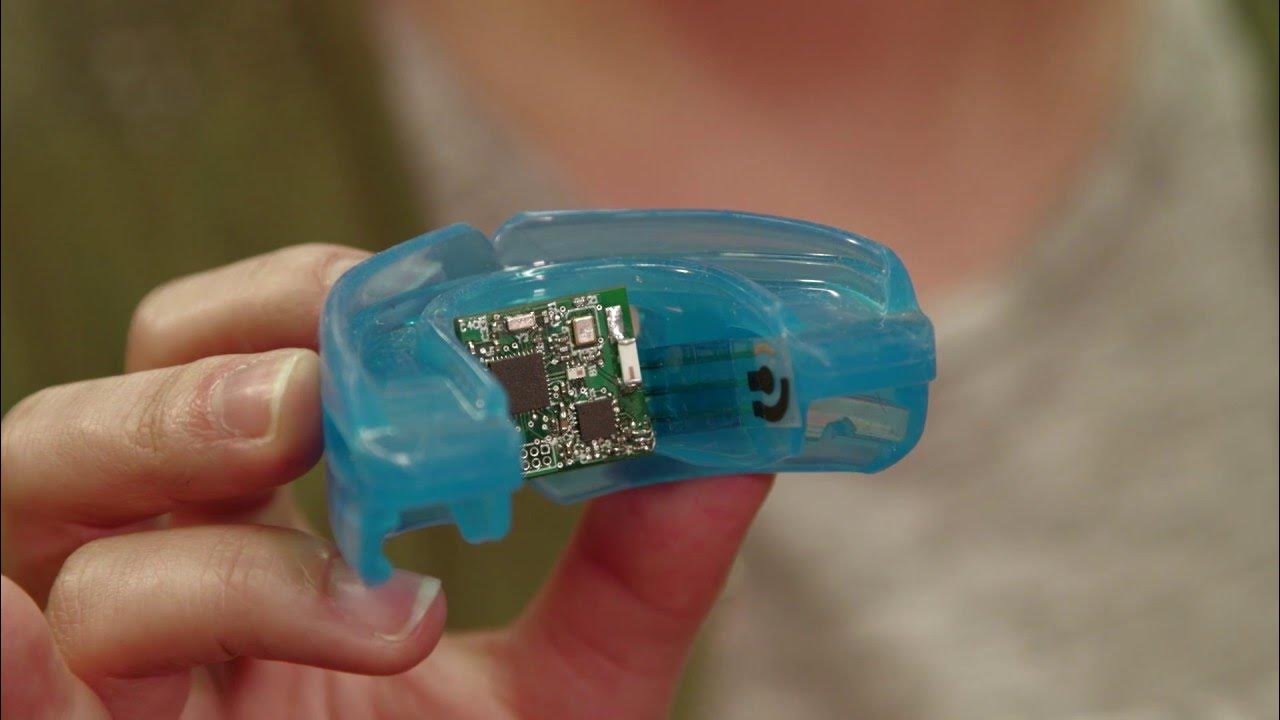 smart mouthguard with sensors