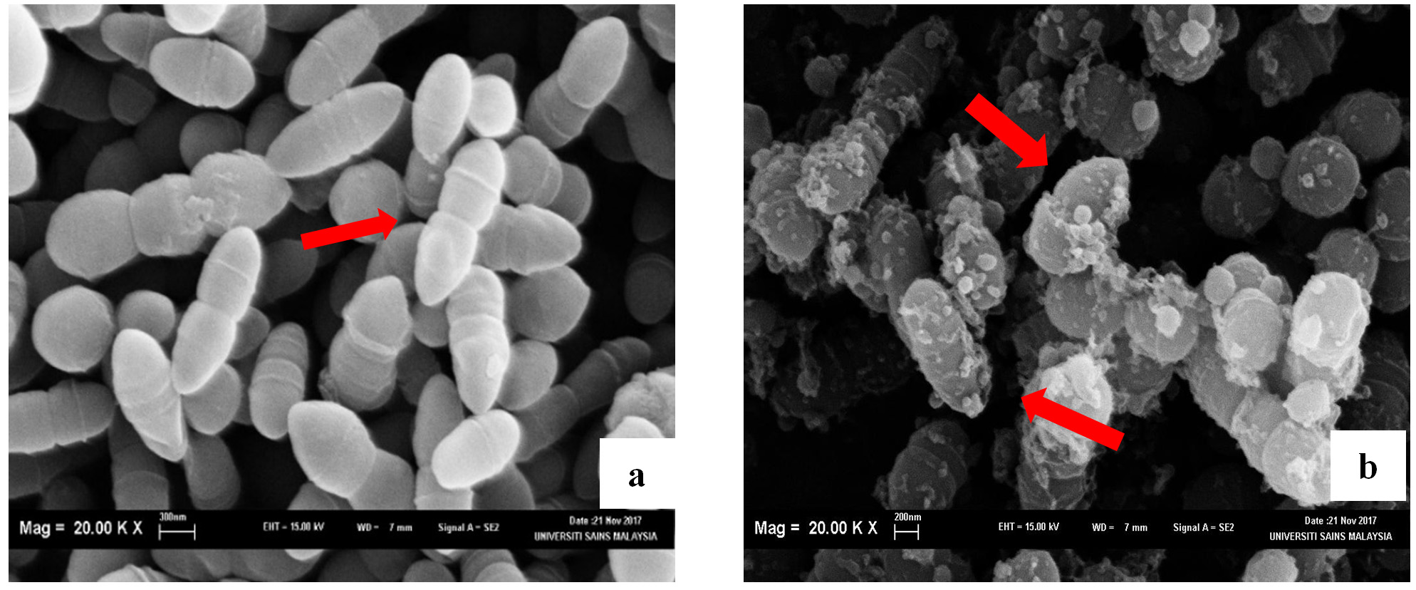 Streptococcus mutans bacteria