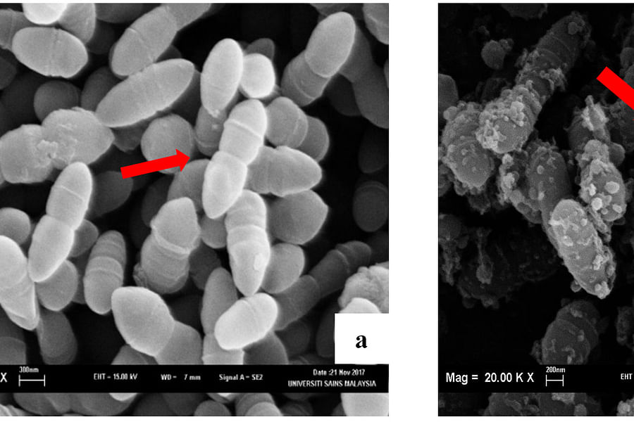 Streptococcus mutans bacteria