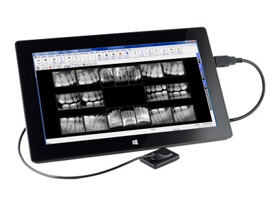 digital dental X-ray system