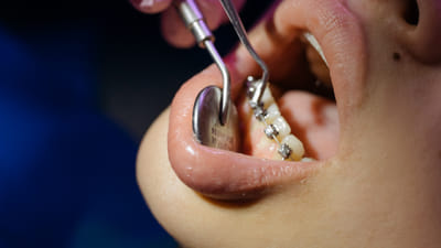 A Look into Dental Forensic Odontology: Career Paths, Education, and Cases