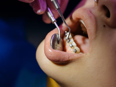 Dental School Acceptance Rates: Understanding Your Chances and How to Improve Them