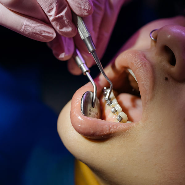 Dental School Acceptance Rates: Understanding Your Chances and How to Improve Them