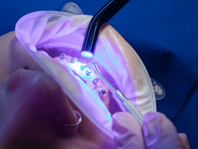 How to Choose the Right Dental School for You: Important Factors to Consider