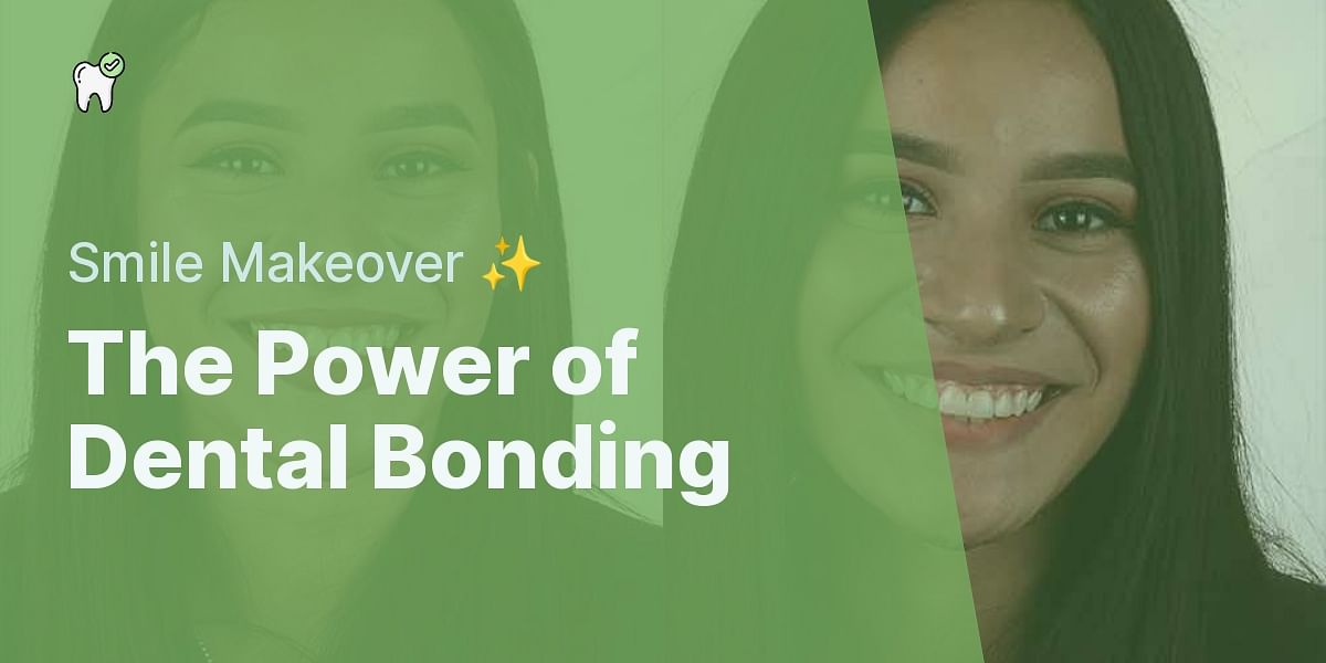 What is dental bonding, and how is it used in cosmetic dentistry?