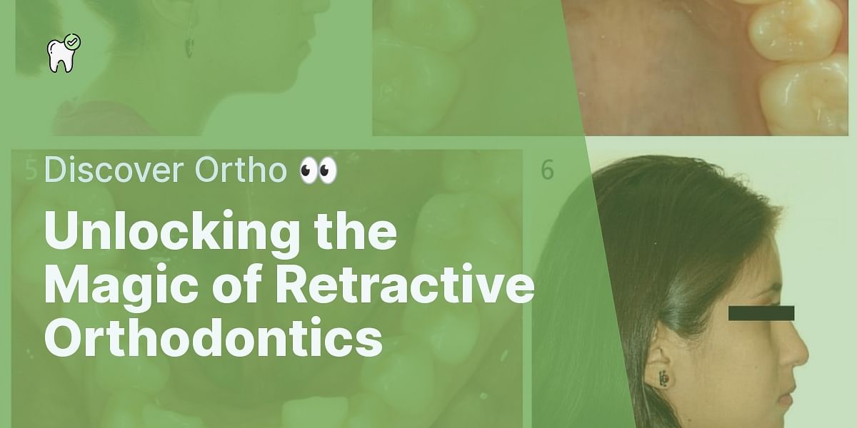 What is retractive orthodontics and what do I need to know about it?