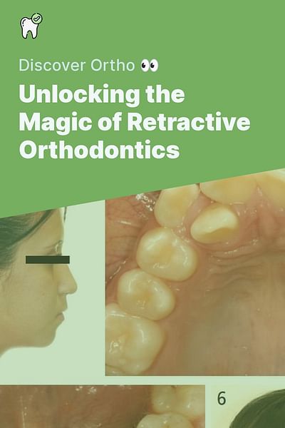 Unlocking the Magic of Retractive Orthodontics - Discover Ortho 👀