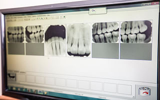 What are the latest trends in dental equipment?